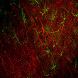 IHC staining rat frontal cortex with Neurofilament-L antibody red and GFAP green STJA0003699