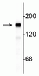 Western blot 145 kDa NF-M protein immunolabeling in rat cortical lysate STJA0003702
