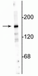 Western blot of 10 µg of rat hippocampal lysate showing specific immunolabeling of the ~180 kDa NR2A subunit.