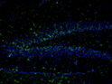Immunostaining of mouse dentate gyrus 48 hours post TMT treatment showing NR2B when phosphorylated at Tyr1336 (green, 1:400). The blue is staining nuclei using DAPI. Photo Courtesy of Rob Wine.