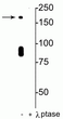 Western blot NR2B subunit phosphorylation in rat hippocampal lysate STJA0003723
