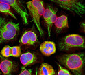 Immunolabeling of HeLa cells stained with anti-nuclear pore complex antibody (STJA0003727, red, 1:100) and rabbit anti-vimentin antibody (STJA0003823, green, 1:10,000). The blue is DAPI staining nuclear DNA. The anti-nuclear pore complex antibody reveals strong granular labeling of the nuclei corresponding to the protein. The anti-vimentin antibody specifically labels intermediate filaments.