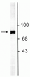 Western blot of rat striatal lysate showing specific labeling of the ~75 kDa NSF protein.