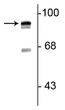 Western blot 93 kDa periostin protein doublet in rat lung lysate STJA0003745