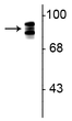 Western blot 93 kDa periostin protein triplet in rat lung lysate STJA0003746
