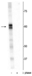 Western blot of Drosophila lysate showing specific immunolabeling of the ~60 kDa PRAS40 protein phosphorylated at Thr356 in the first lane (-). Phosphospecificity is shown in the second lane (+) where the immunolabeling is completely eliminated by blot treatment with lambda phosphatase ( Lambda-Ptase, 1200 units for 30 minutes).