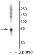 Western blot Raf1 phospho-Ser642 detection in HeLa lysate with phosphatase control STJA0003763