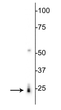 Western blot 24 kDa RBPMS protein detection in rat heart lysate STJA0003764