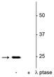Western blot SNAP25 Ser187 phosphospecificity in rat hippocampal lysate STJA0003778