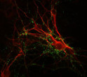 IHC staining with antibody synapsin distribution in mouse caudate neurons STJA0003780