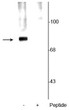 Western blot of rat cortical lysate showing specific labeling of the ~78 kDa synapsin protein phosphorylated at Ser62, 67 in the first lane (-). Phosphospecificity is shown in the second lane (+) where immunolabeling is blocked by preadsorption with the phosphopeptide used as antigen, but not by the corresponding non-phosphopeptide (not shown).