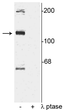 Western blot TAO2 Ser181 phosphorylation in rat cortical lysate with phosphatase control STJA0003794