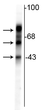 Western blot tau isoforms at 4865and 75 kDa in rat cortical lysate STJA0003795
