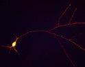 ICC staining rat hippocampal neurons using anti-TAU antibody neuronal processes STJA0003795