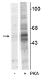 Western blot of recombinant tryptophan hydroxylase incubated in the absence (-) and presence (+) of cAMP-dependent protein kinase showing specific immunolabeling of the ~55 kDa tryptophan hydroxylase protein phosphorylated at Ser58. Western blot of recombinant tryptophan hydroxylase incubated in the absence (-) and presence (+) of cAMP-dependent protein kinase showing specific immunolabeling of the ~55 kDa tryptophan hydroxylase protein phosphorylated at Ser58.
