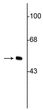 Western blot 50 kDa vimentin protein immunolabeling in HeLa cell lysate STJA0003824
