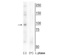 Western blot CtIP phospho-Thr847 immunolabeling in T47D cell lysate STJA0003829