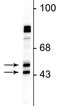 Western blot using antibody FOX3 protein bands at 46-48 kDa in rat cortical lysate STJA0003841