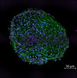 IHC staining human iPSC cerebral organoids Neurofilament-HNeuNand DAPI STJA0003841