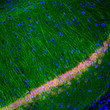 IHC staining rat hippocampus section FOX3 labeling neurons in red with DAPI STJA0003841