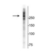 Western blot MAP2 protein 280 kDa immunolabeling in rat cortical lysate STJA0003848