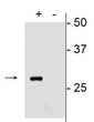 Western blot mCherry protein detection in transfected vs untransfected HEK293 lysate STJA0003850