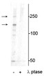 Western blot XIRP1 phospho-Ser295 detection in mouse heart lysate with phosphatase control STJA0003857