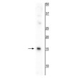 Western blot AIF1-Iba1 protein 17 kDa detection in mouse spleen lysate STJA0003858