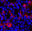 Immunofluorescence of SARS-CoV-2 transfected HEK293 cells showing specific staining of SARS-CoV-2 in red. Nuclei are visualized in blue with DAPI.