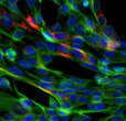 Immunofluorescence SARS-CoV-2 transfected HEK293 cells in red and nuclei with DAPI STJA0003863