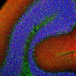 alpha-synuclein antibody IHC staining in rat cerebellum with GFAP co-staining STJA0003866