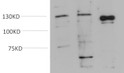 Western blot analysis of 1) K562 Cell, 2) 3T3 Cell, 3) PC12 Cell lysate using JAK2 mouse Monoclonal monoclonal antibody diluted at 1:2,000.
