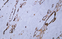 Human kidney tissue was stained with Anti-Cytokeratin 7 (ABT319) Antibody