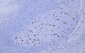 Immunohistochemistry - Paraffin (IHC-P): Human tonsil tissue was stained with Anti-CD68 (ABT-CD68) antibody. STJ196750
