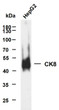 HepG2 whole cell lysates were separated by 10% SDS-PAGE, and the membrane was blotted with anti-CK8 (ABT534) antibody. The HRP-conjugated Goat anti- mouse IgG (H + L) antibody was used to detect the antibody. Lane 1: HepG2Predicted band size: 54kDaObserved band size: 54kDa