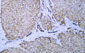 Human liver tissue was stained with Anti-Cytokeratin 8 (ABT534) Antibody