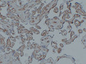 Immunohistochemical analysis of paraffin-embedded Placenta. 1, Antibody was diluted at 1:200 (4°C overnight). 2, Citric acid, pH6.0 was used for antigen retrieval. 3, Secondary antibody was diluted at 1:200 (room temperature, 30min).