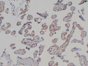 Immunohistochemical analysis of paraffin-embedded Placenta. 1, Antibody was diluted at 1:200 (4°C overnight). 2, Citric acid, pH6.0 was used for antigen retrieval. 3, Secondary antibody was diluted at 1:200 (room temperature, 30min).