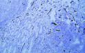 Immunohistochemistry - Paraffin (IHC-P): Human appendix tissue was stained with Anti-CD31 (ABT-CD31) antibody. STJ196788