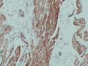 Immunohistochemistry - Paraffin (IHC-P): Human cardiac muscle tissue was stained with Anti-Actin pan (ABT-ACTN) STJ196801