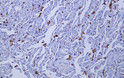 Human lung tissue was stained with anti-CD163 (ABT-CD163) antibody.