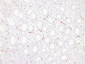 Immunohistochemical analysis of paraffin-embedded appendix. 1, Antibody was diluted at 1:200 (4° overnight). 2, STJ196809