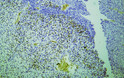 Human rhabdomyosarcoma tissue was stained with Anti-Myogenin (ABT-MYOG) Antibody