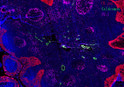 Fluorescence multiplex immunohistochemical analysis of normal human appendix tissue (formalin-fixed paraffin-embedded section). The section was incubated in 3 rounds of staining; in the order of CK PAN. (STJ197095 1/200 dilution), PD-1. (STJ196857 1/200 dilution), Caldesmon pan. (STJ197106 1/200 dilution), each using a separate fluorescent tyramide signal amplification system : Treble-Fluorescence immunohistochemical mouse/rabbit kit (pH9.0)