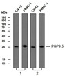 Various whole cell lysates were separated by 12% SDS-PAGE, and the membrane was blotted with anti-PGP9. 5antibody. The HRP-conjugated anti- mouse IgG antibody was used to detect the antibody. Lane 1：Anti-PGP9. 5 antibody at 1ug/ml Lane 2：Anti-PGP9. 5 antibody at 0. 5ug/mlPredicted band size: 25 kDa