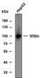 Western Blot (WB): Whole cell lysates of HepG2 were separated by 8% SDS-PAGE, and the membrane was blotted with STJ196870