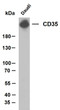 Whole cell lysates were separated by 10% SDS-PAGE, and the membrane was blotted with anti-CD35 (ABT-CD35) antibody. The HRP-conjugated Goat anti- mouse IgG (H + L) antibody was used to detect the antibody. Lane 1: DaudiPredicted band size: 180kDaObserved band size: 250kDa