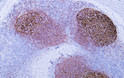 Human tonsil tissue was stained with Anti-CD35 (ABT-CD35) Antibody