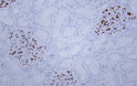 Human kidney tissue was stained with Anti-Wilms' Tumor 1 (WT1) (ABT-WT1) Antibody