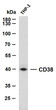 THP-1 whole cell lysates were separated by 10% SDS-PAGE, and the membrane was blotted with anti-CD38 (ABT-CD38) antibody. The HRP-conjugated Goat anti- mouse IgG (H + L) antibody was used to detect the antibody. Lane 1: THP-1Predicted band size: 34kDaObserved band size: 40kDa